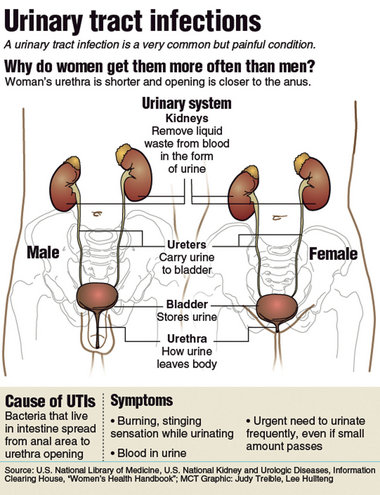 Women Are More Prone to Developing UTIs Than Men For Several Reasons