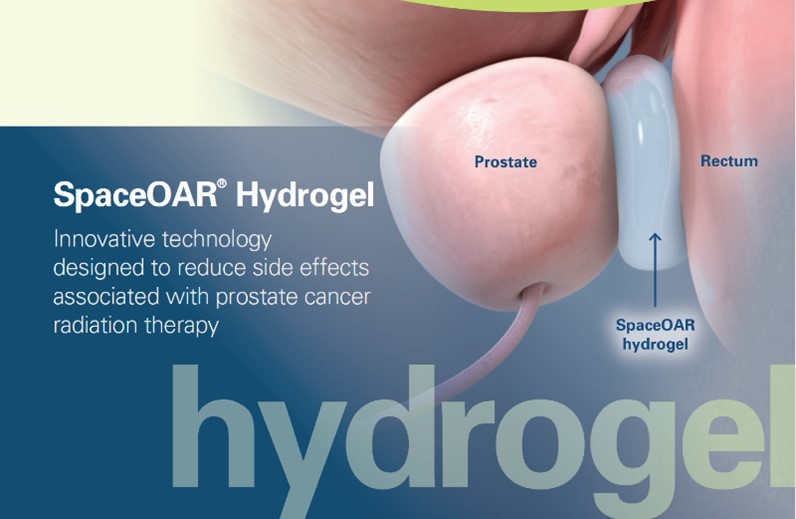 SpaceOar Hydrogel is There to Reduce Radiation Treatment Side Effects
